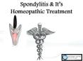 Spondylitis Homeopathic Treatment for safe & Permanent Solution PowerPoint PPT Presentation