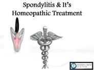 Spondylitis Homeopathic Treatment for safe & Permanent Solution