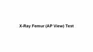 X-Ray Femur (AP View) Test