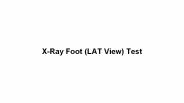 X ray foot (lat view) test