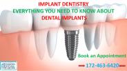 Implant Dentistry in Chandigarh