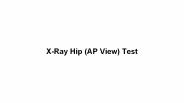X ray hip (ap view) test