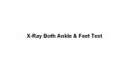 X ray both ankle & feet test