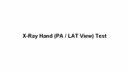 X ray hand test