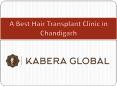 Best Hair Transplant Clinic in Chandigarh PowerPoint PPT Presentation