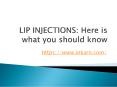 LIP INJECTIONS: Here is what you should know PowerPoint PPT Presentation