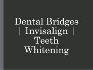 Dental Bridges | Invisalign | Teeth Whitening