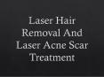 Laser Hair Removal And Laser Acne Scar Treatment PowerPoint PPT Presentation