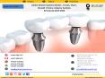 Global Dental Implants Market , Trends, Share,  Growth  Drivers, Industry Analysis   & Forecast 2017-2025 PowerPoint PPT Presentation