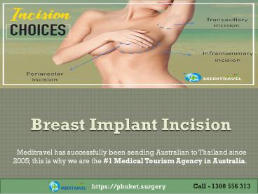 Breast Implant Incision Choice