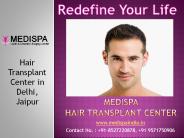 Best Hair Transplant Clinic in Delhi | India