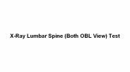 X-Ray Lumbar Spine (Both OBL View) Test