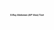 X ray abdomen (ap view) test