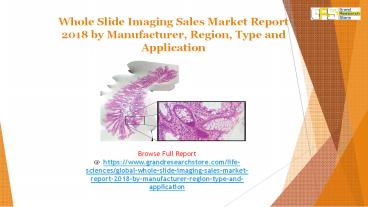 Whole Slide Imaging Sales Market Report 2018 by Manufacturer, Region, Type and Application