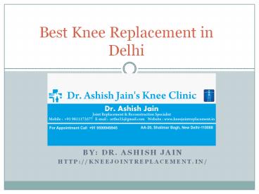 Best Knee Replacement in Delhi