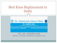 Best Knee Replacement in Delhi