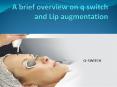 A brief overview on q switch and Lip augmentation PowerPoint PPT Presentation