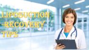 Liposuction-Recovery Tips