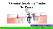 7 dental implants truths to know