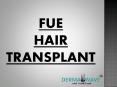 best hair transplant clinic in panipat PowerPoint PPT Presentation
