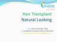 Skin, Laser and Hair Transplant clinic in Hyderabad PowerPoint PPT Presentation