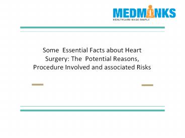 Some  Essential Facts about Heart Surgery