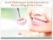 Teeth Whitening & Tooth Extraction in Bryan college Station Texas
