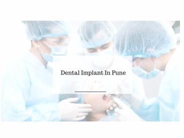 Dental Implants in Pune- Devs Oral Care