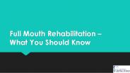 Full Mouth Rehabilitation – What You Should Know