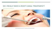 Do I Really Need A Root Canal Treatment