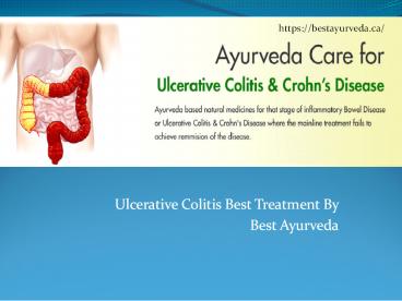 Ulcerative Colitis | Ulcerative Colitis Treatment – Bestayurveda
