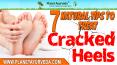 7 Natural Tips To Treat Cracked Heels At Home PowerPoint PPT Presentation
