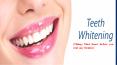 Teeth Whitening | Best Dental clinic in Vaishali Ghaziabad PowerPoint PPT Presentation