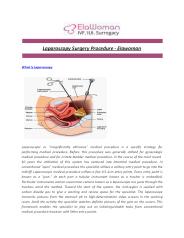 Laparoscopy Surgery Procedure - Elawoman