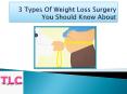 3 Types Of Weight Loss Surgery You Should Know About PowerPoint PPT Presentation