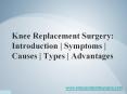 Knee Replacement Surgery-Introduction,Symptoms,Causes,Types,Advantages PowerPoint PPT Presentation