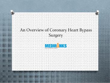 An Overview of Coronary Heart Bypass Surgery