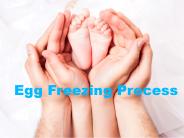 Egg Freezing Process Timeline: IVFLA Fertility