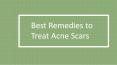 Best Remedies to Treat Acne Scars PowerPoint PPT Presentation