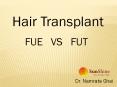 hair transplant in delhi (1) PowerPoint PPT Presentation