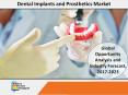 Dental Implants and Prosthetics Market to Reach $12,743 Mn by 2023 PowerPoint PPT Presentation