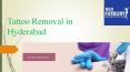 Laser Tattoos Removal Treatment Procedure With High Technology PowerPoint PPT Presentation