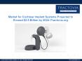 Cochlear Implant Systems market to reach $2.5B: 5 things to know PowerPoint PPT Presentation