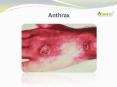 Anthrax PowerPoint PPT Presentation
