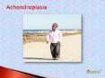 Achondroplasia (1) PowerPoint PPT Presentation
