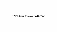 Mri scan thumb (left) test