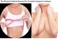 Labiaplasty vaginal tightening PowerPoint PPT Presentation