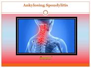 Ankylosing Spondylitis