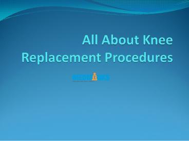 All about Knee Replacement Procedures