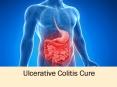 Shop Online Ayurveda Based Capsules for Ulcerative Colitis PowerPoint PPT Presentation